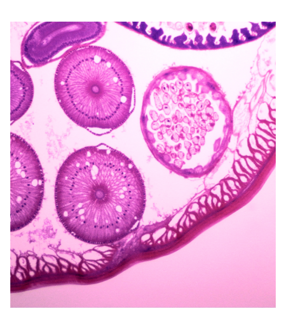 Ovarian Cancer Cells